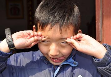 儿童抽动症分为哪些类型? 儿童抽动症分为哪些类型?